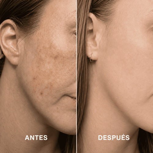 Amara | Crema 7% Arbutina + 4% Ácido Tranexámico
