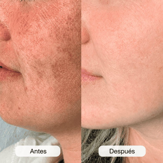 Amara | Crema 7% Arbutina + 4% Ácido Tranexámico